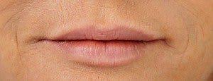 Lips_After