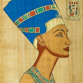 Nefertiti neck - botox injections