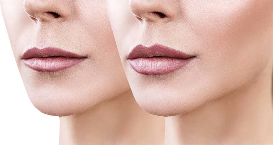 Luscious Lips
