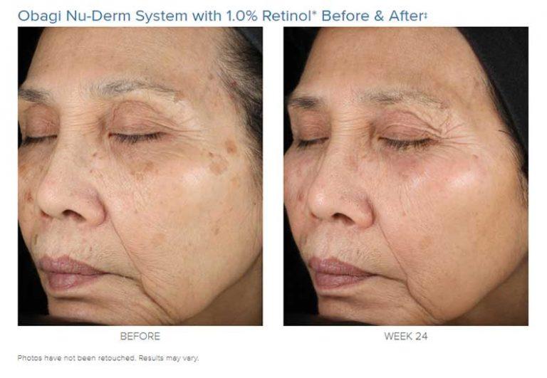 Obagi Obagi Nu-Derm System